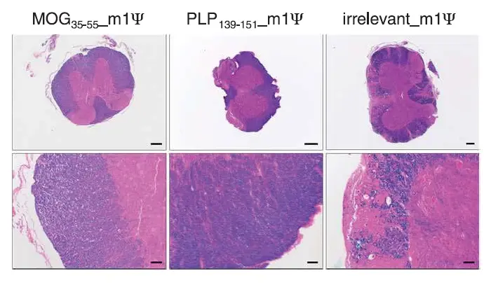 Un estudio publicado en la revista science demuestra la capacidad de las vacunas de MRNA para prevenir las lesiones desmielinizantes en ratones con EAE