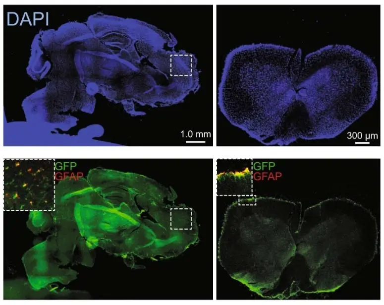 Investigadores del Brigham and Women's Hospital de Boston encuentran astrocitos anti-inflamatorios dirigidos por la microbiota intestinal