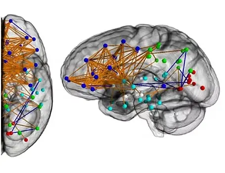Controlar la inflamación, clave para evitar el empeoramiento de la esclerosis múltiple
