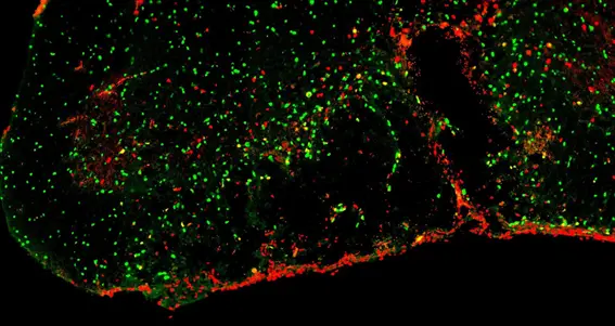Investigadores de la Universidad de Buffalo revelan cómo el cerebro inhibe la remielinización en un modelo animal de EM y cómo tratarla
