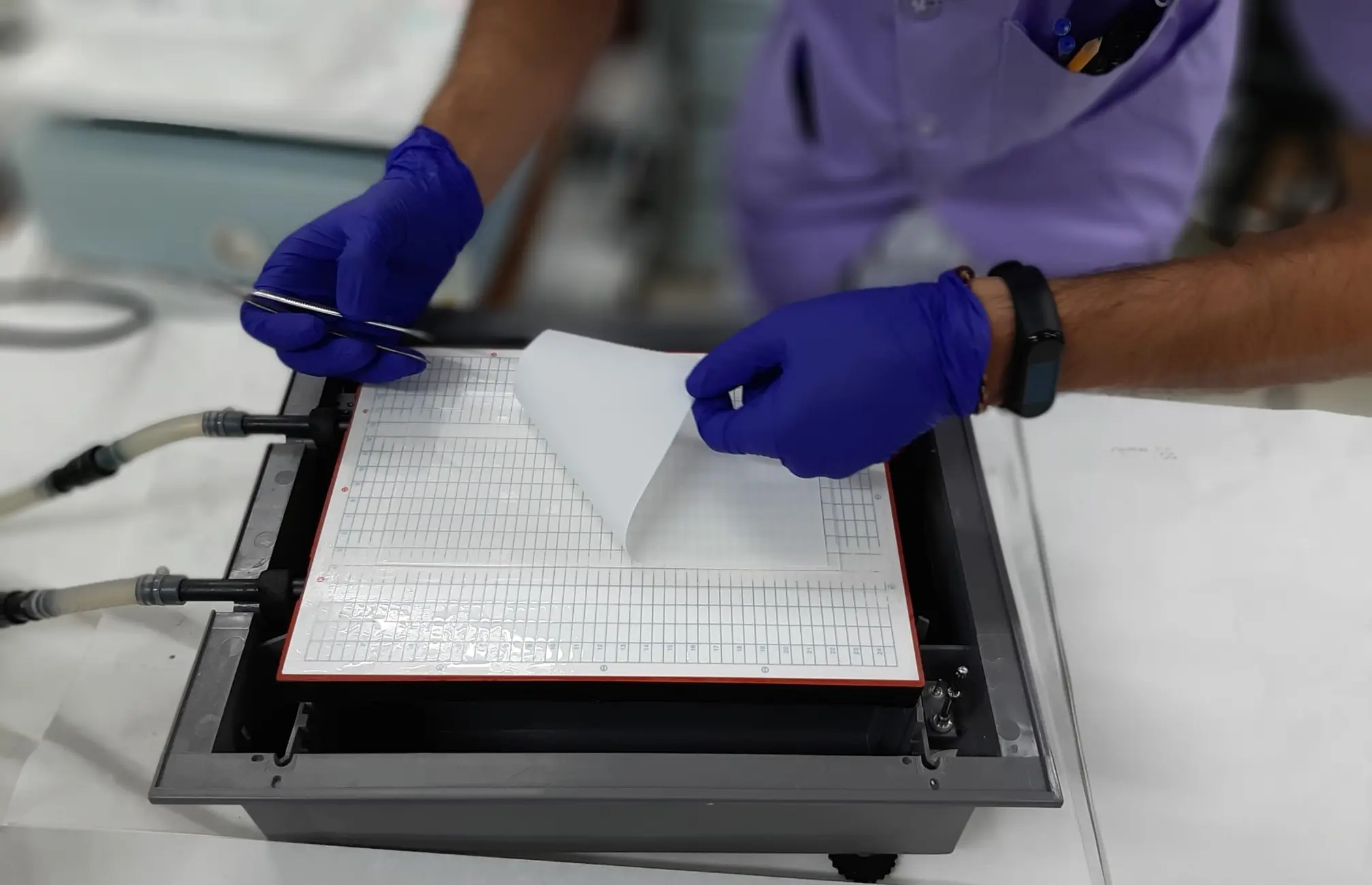 Investigadores REEM publican dos artículos sobre la inmunosenescencia precoz en la EM