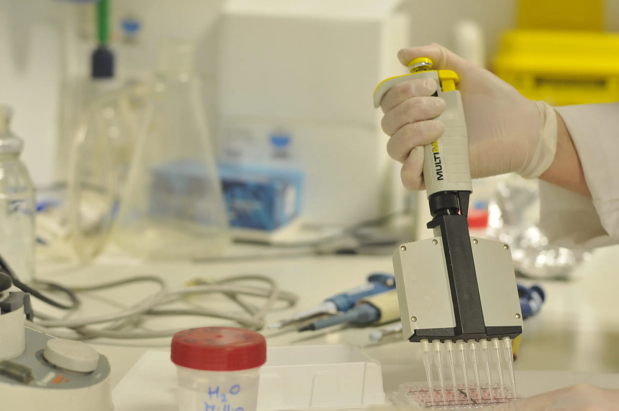 La Asociación de Pacientes EM España colabora con la REEM con 50.000 euros para financiar dos proyectos de investigación en EMPP